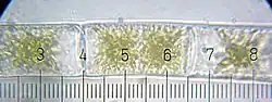 Zygnema.&nbsp; Each numbered tick = 20 μM