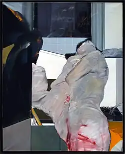 Transplantation (1972)