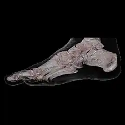 CT 3D human Foot Skin and Bone