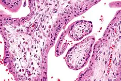 Micrograph showing chorionic villi. Very high magnification. H&E stain.