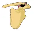 Classification type 4