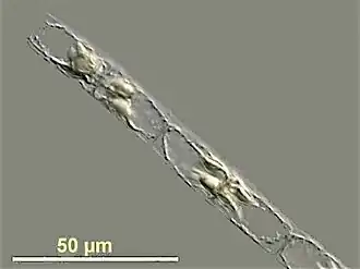 Guinardia delicatula, a diatom responsible for diatom blooms in the North Sea
