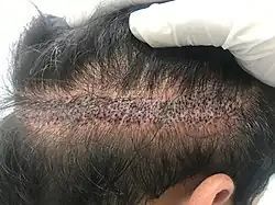 Hair Tattoo