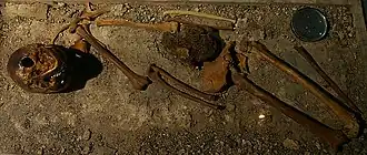 A skeleton lying upright, with some of its bones missing and its detached skull rolled over so that the chin pointing straight up