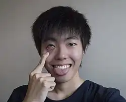 Akanbē is a Japanese facial gesture performed by pulling down the lower eyelid to reveal the reddish underside of the eye, often accompanied by sticking out the tongue
