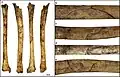 Burial 22. Perimortem butterfly fracture on the tibia.
