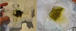 This image compares the appearance of meconium (from 48 hours after normal delivery at term) to the appearance of the same infant's feces after 1 week of breastfeeding.