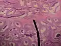 Microscopic picture.