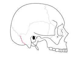 Occipitomastoid suture