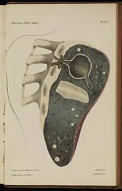Color engraving depicting a cross-section of a lung.