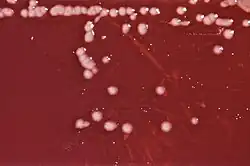 "P. aeruginosa" colonies on an agar plate