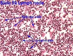 Reticular cells as seen in Liver.