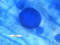 An intraradical spore of arbuscular mycorrhizal fungi