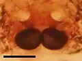 Epigyne (ventral view). Scale equals 0.1 mm.